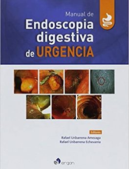 Manual de Endoscopia Digestiva de Urgencia